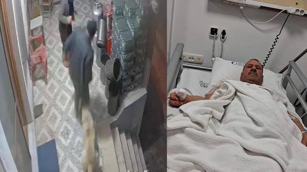 Köpek saldırısına parmağı koptu; o anlar kamerada