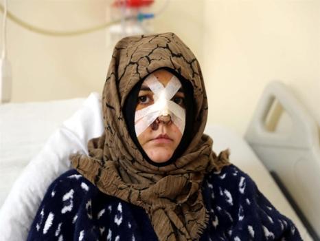 Boşanma aşamasındaki eşine vurduğu kaldırım taşı 'silah' sayıldı