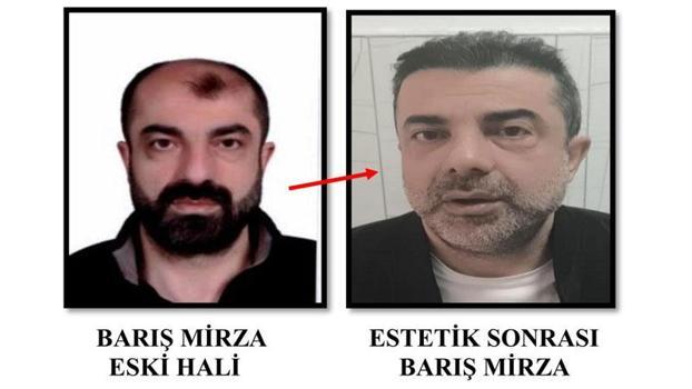 Cinayette azmettirmekten aranan şüpheli, ameliyatla yüzünü değiştirmiş