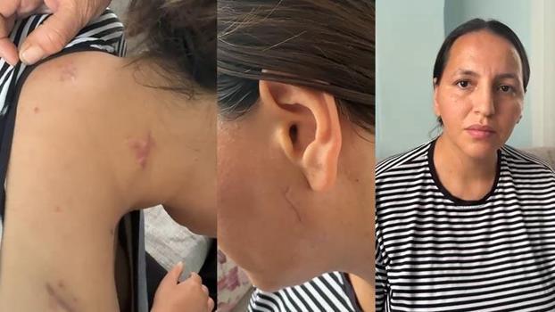 17 bıçak darbesiyle yaralanan Havva, tutuklanan eşinin en ağır cezayı almasını istedi