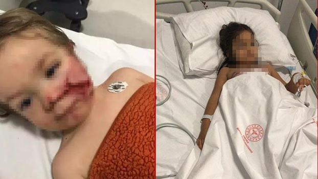 Ankara'da 2 kardeşi yaralayan pitbullun sahibinin annesi hakkında suç duyurusu kararı