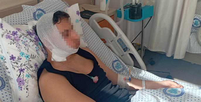 Lise öğrencilerinin darp davası: Çenesi nasıl kırıldı anlam veremedik