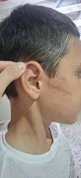 Babasının darbettiği 12 yaşındaki çocuk koruma altına alındı