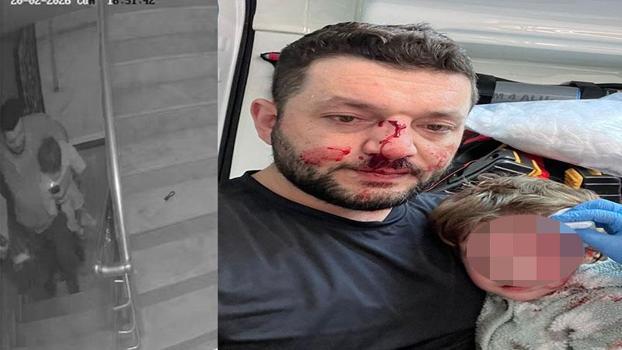 Kucağında bebeği olan babayı darbeden şüpheli adli kontrolle tahliye edildi