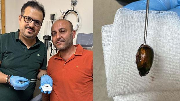 Ağrı ve işitme kaybı nedeniyle gittiği hastanede, kulağından böcek çıktı
