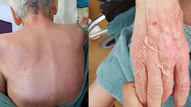 Huzurevinde ölüme verilen taksitli para cezasının gerekçesi: Gerekli tedbirler alınmamış
