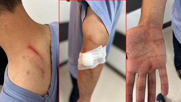 İlaç raporu tartışmasında tıbbi sekreteri darbetti