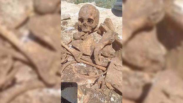 Malatya'da inşaat kazısında insan kemikleri bulundu
