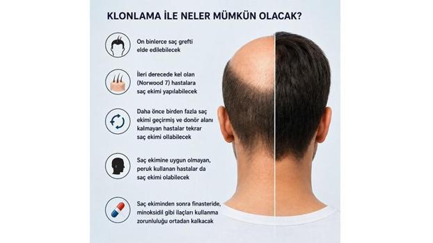 ‘Saç klonlaması, tedavide yeni bir çağın kapısını aralıyor’