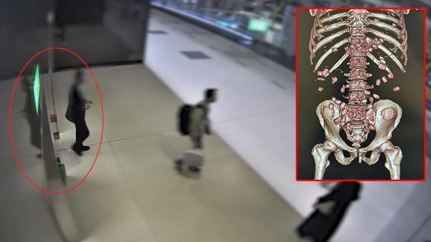 İstanbul Havalimanı'nda durdurulan ÅŸüphelinin midesinden 26 kapsül uyuÅŸturucu çıktı