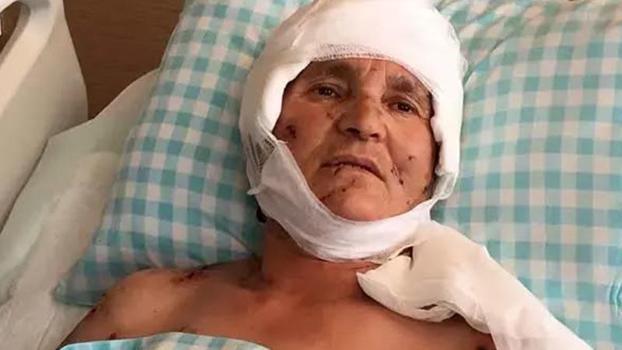 Köpek saldırısında yaralanan kadına 637 bin lira tazminat kararı