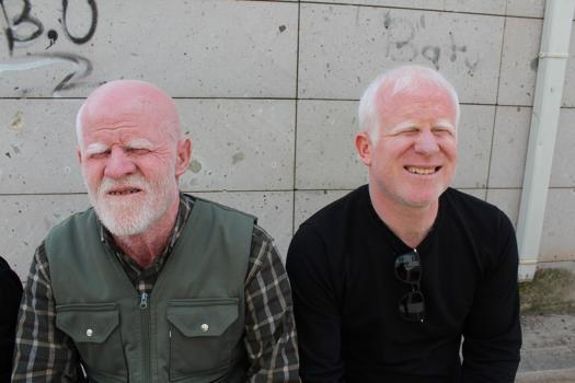 Ailesinin geçimi, babası ve kardeşi gibi kendisi de albino olan Gökhan’a emanet