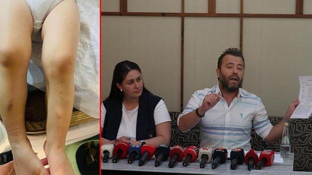 Kreşte 2 yaşındaki çocuğa darp iddiasına takipsizlik kararı