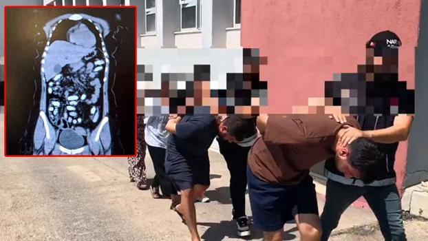 Midesinde 1,5 kilo metamfetaminle yakalanan 2 kadın kurye tutuklandı