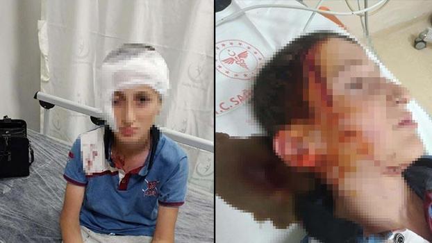 11 yaşındaki çocuğa köpek saldırısında 1,2 milyon TL tazminat kararı