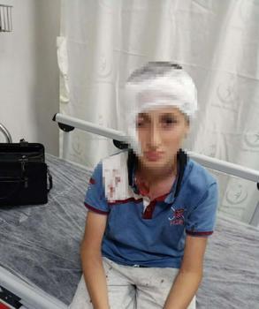 11 yaşındaki çocuğa köpek saldırısında 1,2 milyon TL tazminat kararı