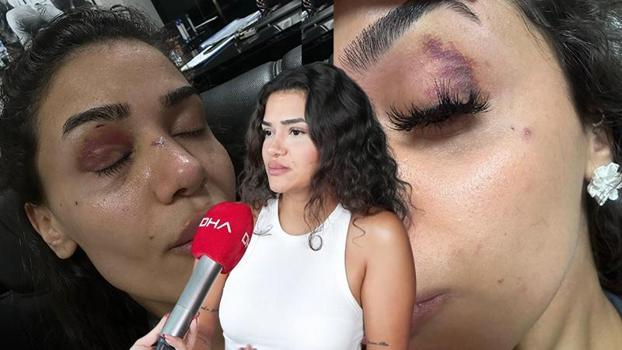 Bahçeşehir'de uzaklaştırma kararına rağmen evinin önünde darbedilen Ebru: Ölmeden önce sesimi duyun
