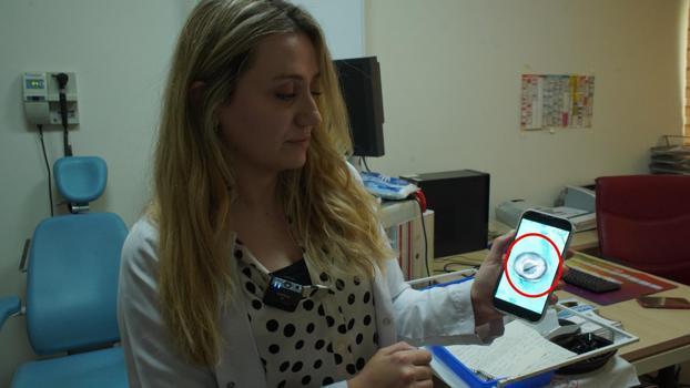 Siirt'te 10 yaşındaki çocuğun boğazından canlı sülük çıktı
