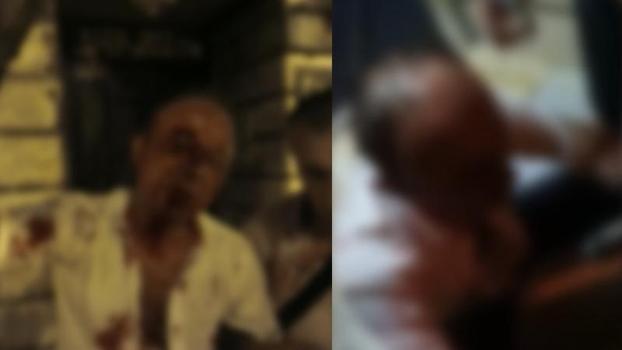 Beyoğlu’nda 'yan bakma’ kavgasında darbedilip kanlar içinde kaldı: Her şeyim patladı