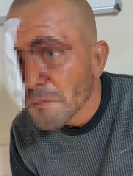 Sanal medyadaki videoları ile tanınan zihinsel engelli darbedildi