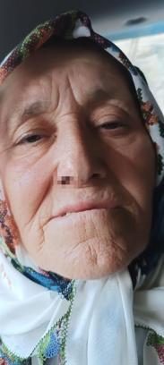'Goruk' fındık tartışmasında 73 yaşındaki kadını darbettiler; 3 gözaltı