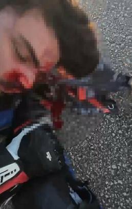 Bariyere çarpan motosikletin sürücüsü ağır yaralandı; kaza kask kamerasında