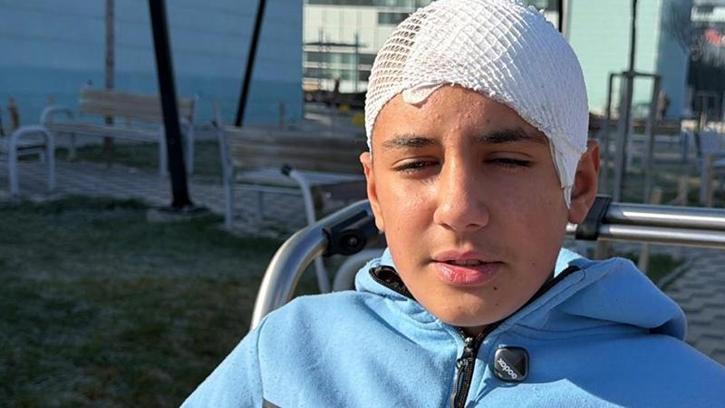 Şakalaştığı okul arkadaşı, taşla Hasan Berat’ı hastanelik etti