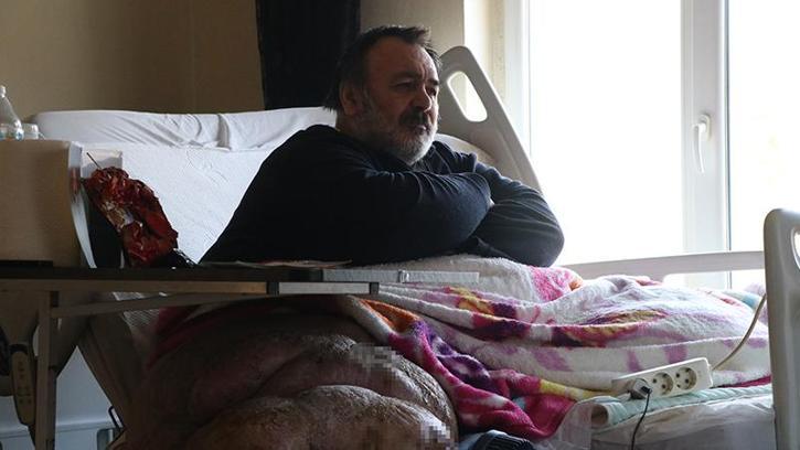 5 yıldır evden çıkamayan 300 kiloya ulaşan fil hastasının hayali; eşiyle kol kola caddede gezmek