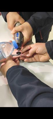 Parmağına sıkışan yüzüğü itfaiye çıkardı