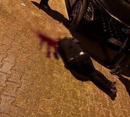 Sokakta yürürken tabanca ile başından vuruldu