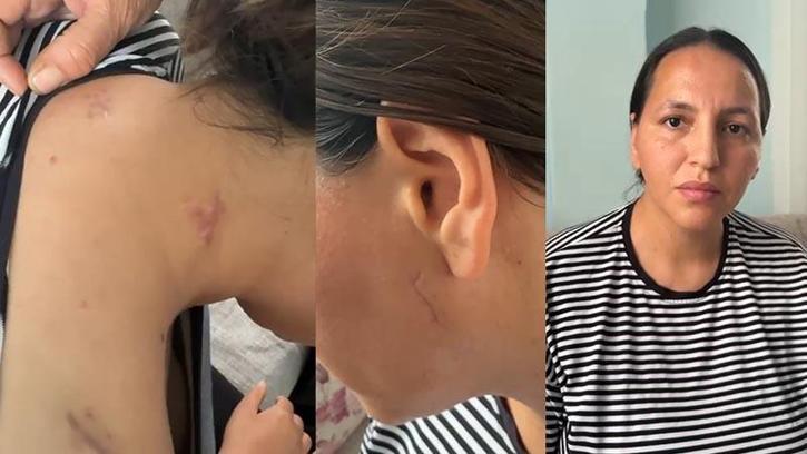 17 bıçak darbesiyle yaralanan Havva, tutuklanan eşinin en ağır cezayı almasını istedi