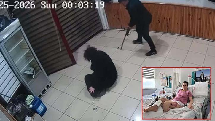Boşanma aşamasındaki eşini bacaklarından vuran sanık: İçeride ne oldu, hatırlamıyorum