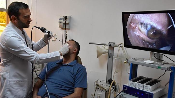 Burundan girilip gözyaşı kanalına yapay tüp yerleştirilen hasta sağlığına kavuştu