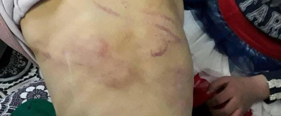 Babasının işkence yapıp dilendirdiği iddia edilen kız çocuğu, devlet korumasında