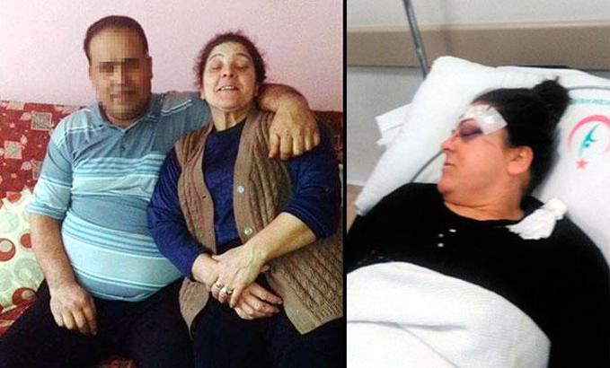 Boşanma davası açan eşine sokakta tornavida ile saldırdı