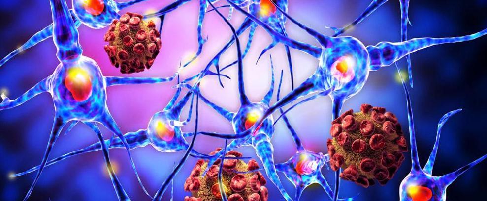 Doç. Dr. Korkmaz: MS hastaları sıcaktan kaçınmalı