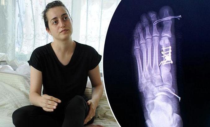 Sağlam parmağa ameliyatla suçlanan doktor geri adım atmadı