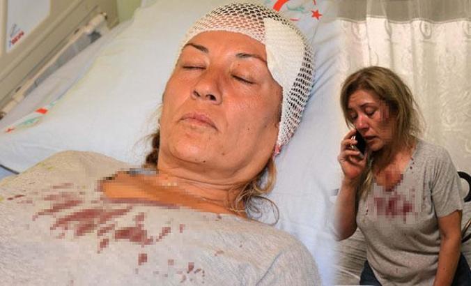 Sokak hayvanlarını besleyen kadın komşusunu taşla yaraladı