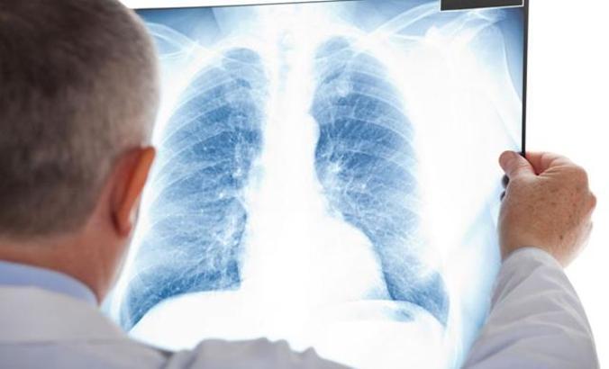 Zatürre, çocuklarda ve yaşlılarda hayati tehlikeye yol açıyor