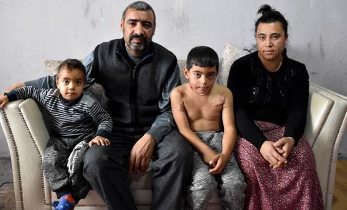 Siraç, vücudundaki yanıklar yüzünden okula gitmiyor