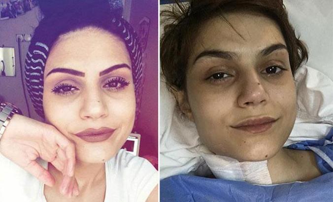 Kanser tedavisi gören Ayla, yaşama tutunamadı