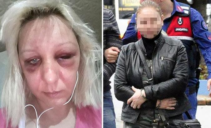 Kırgız kadın, vatandaşı kadınlar tarafından dövülüp, fuhuşa zorlandı