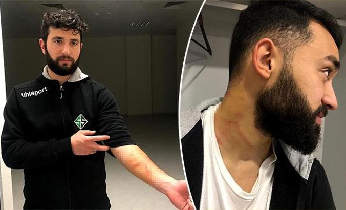 Sakaryasporlu futbolculardan Amedsporlu bazı futbolcular hakkında suç duyurusu