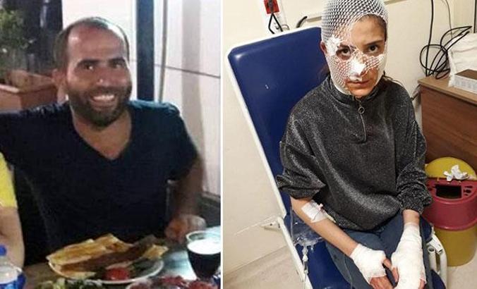 Vücuduna 80 dikiş atılan genç kadından, saldırgana 8 yıl hapis cezası istenmesine tepki