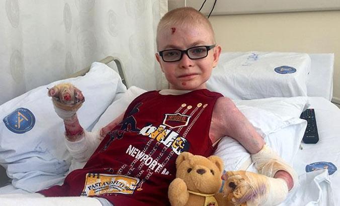 Kelebek hastası Ünal'a 40'ıncı ameliyat