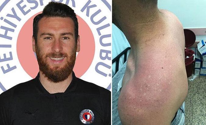 Fethiyespor'da darp iddiası