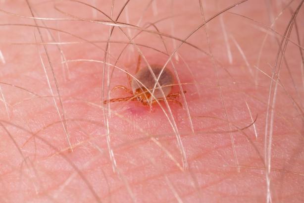 Kırım Kongo Kanamalı Ateşi'nde ölüm oranı yüzde 5