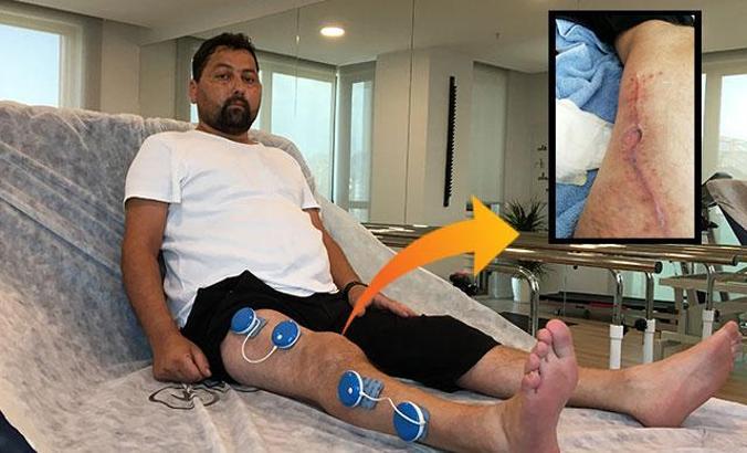 Bacağına sülfürik asit döküldü, 13 gün boyunca gemide tedavi edilmeye çalışıldı