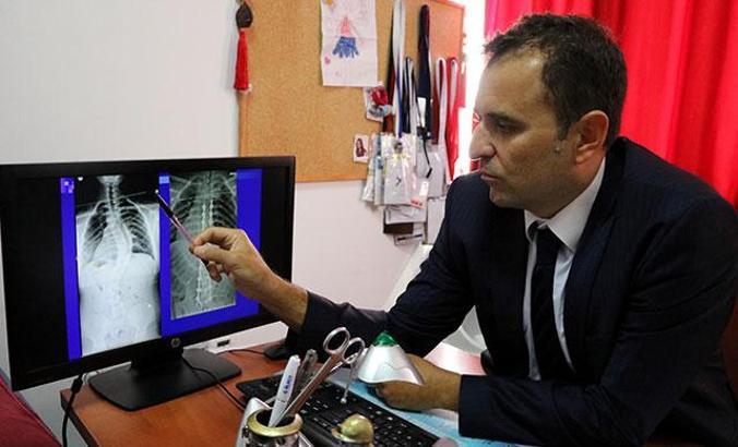 Her 100 çocuktan 3'ünü etkileyen hastalık; skolyoz