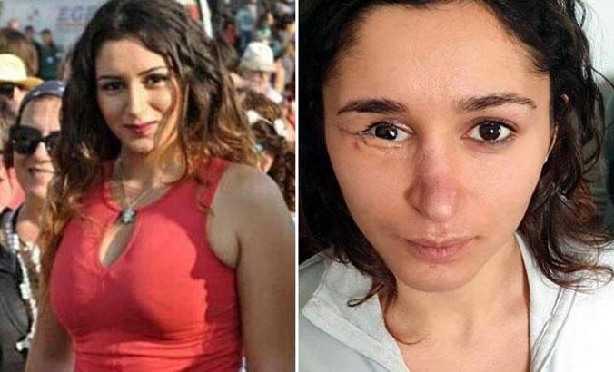 Tuğçe'nin yüzünün parçalandığı tüfekli saldırı davası ağır cezada